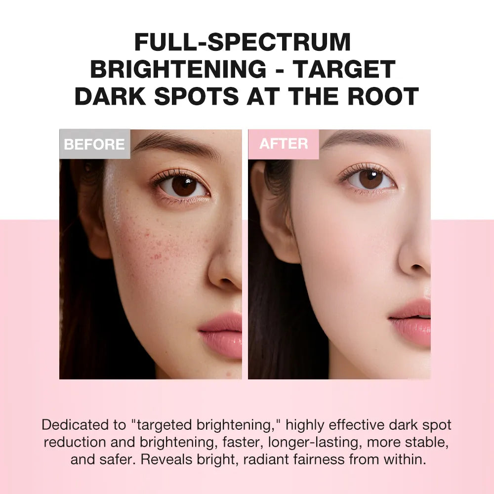 SKINEVER 10% Niacinamide Spot-Lightening Cream