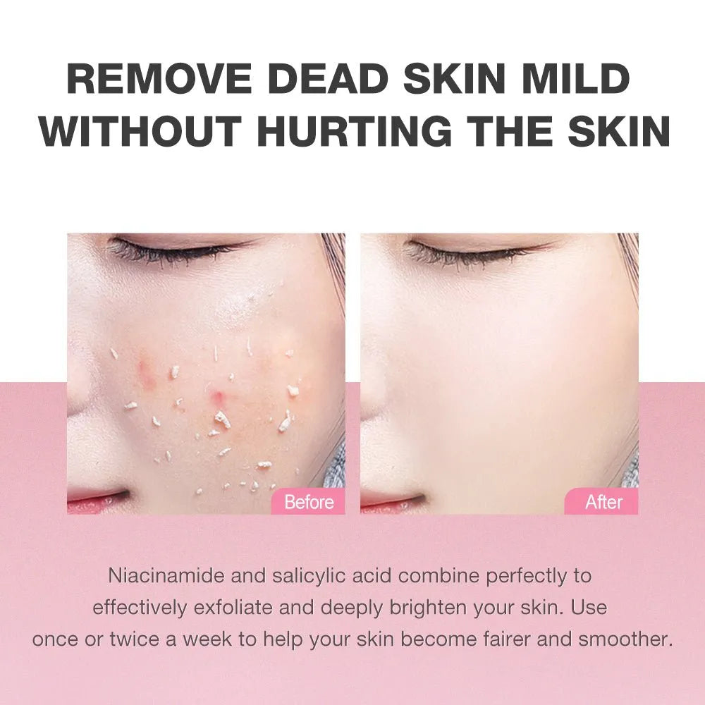 SKINEVER 3% Niacinamide Exfoliating Whitening Gel