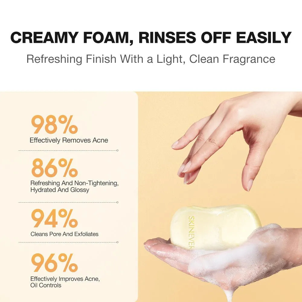 SKINEVER Salicylic Acid Refreshing Acne Soap