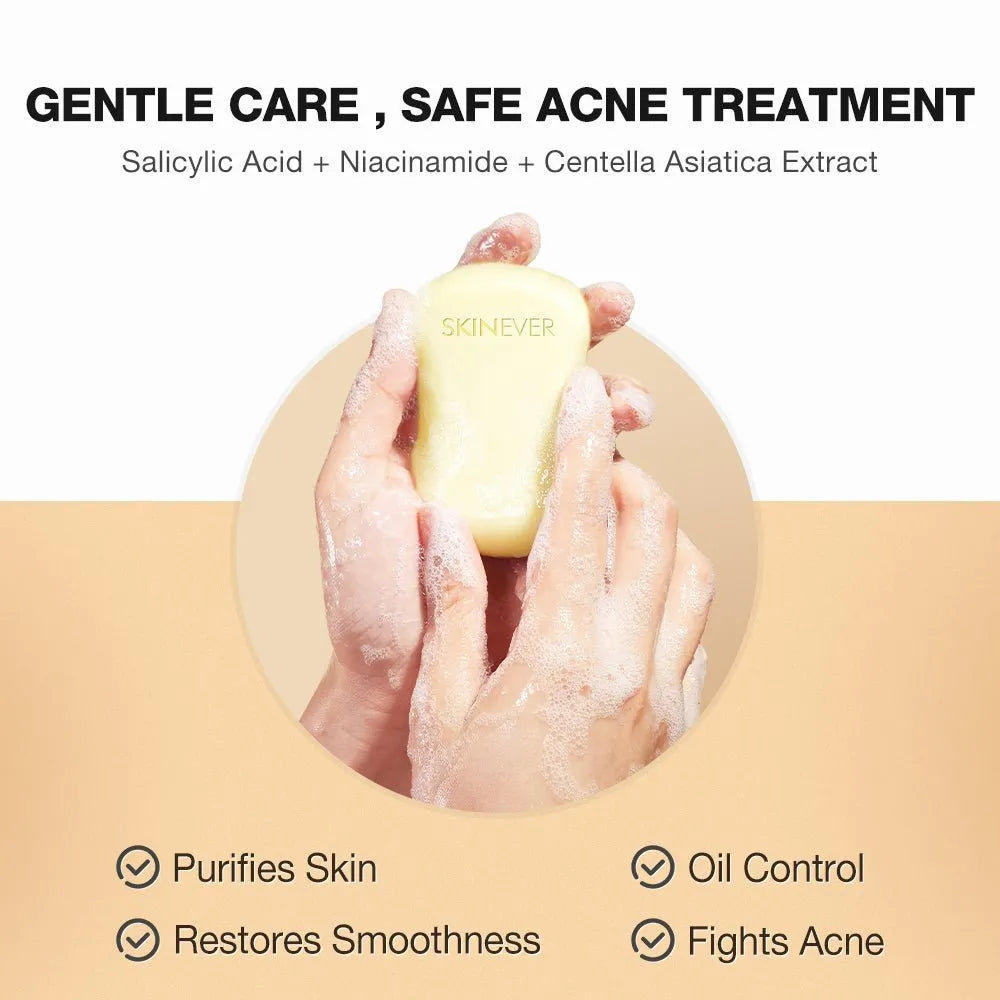 SKINEVER Salicylic Acid Refreshing Acne Soap