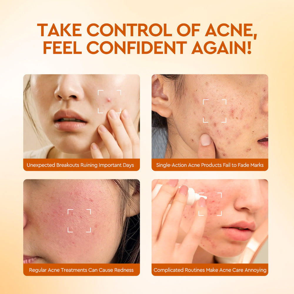 Salicylic Acid Acne Soothing Dual-Action Serum