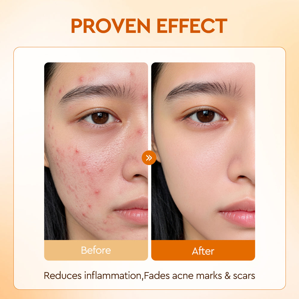 Salicylic Acid Acne Soothing Dual-Action Serum
