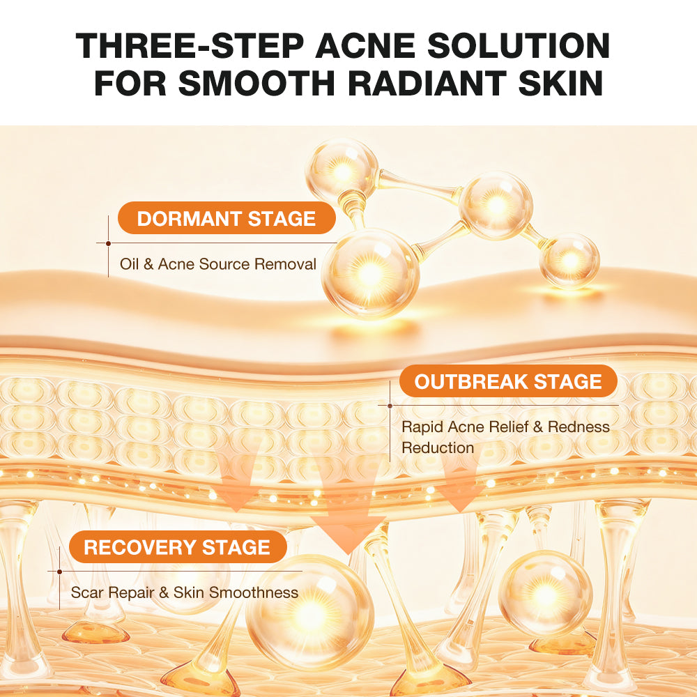 Salicylic Acid Refreshing Acne Skin Body Wash