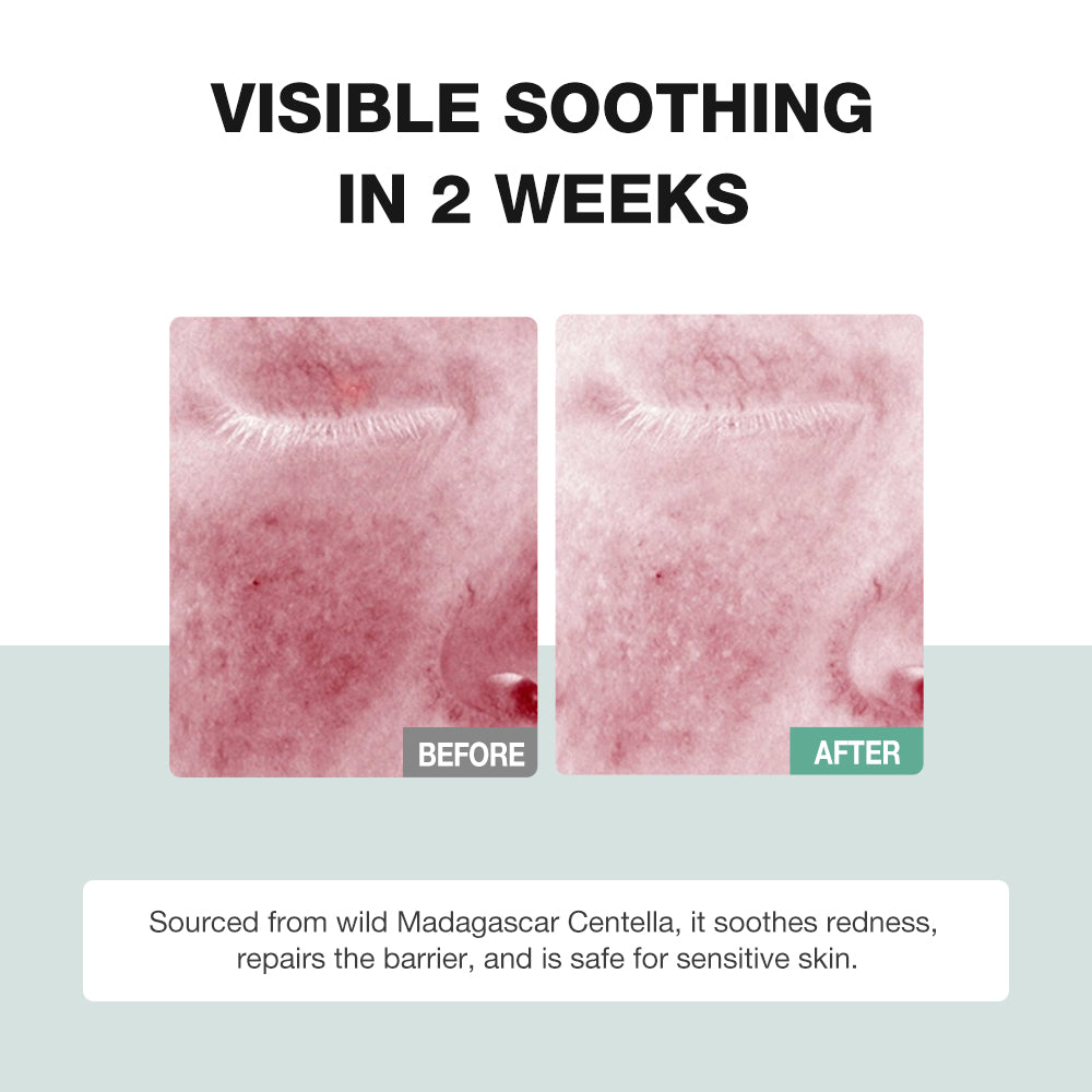 Centella Asiatica Soothing Essence