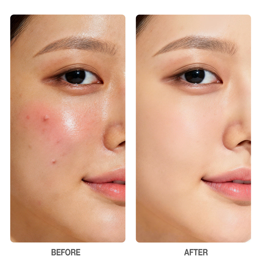 Salicylic Acid Oil Control Exfoliating Toner - 80ml