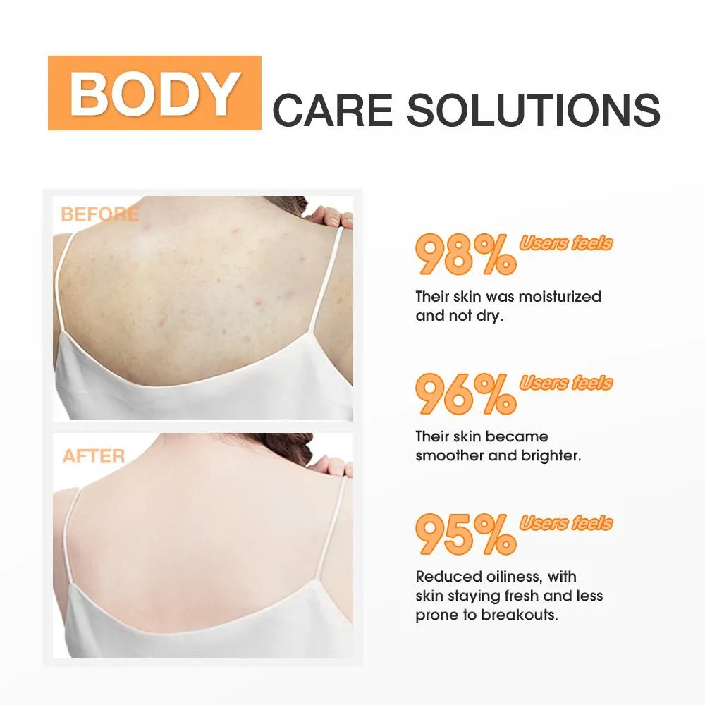 SKINEVER Salicylic Acid Exfoliating Body Lotion Cleanses The Skin Moisturizing Skin Care