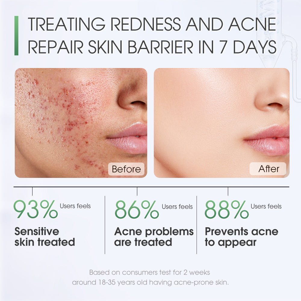 Centella Skin Soothing Masque