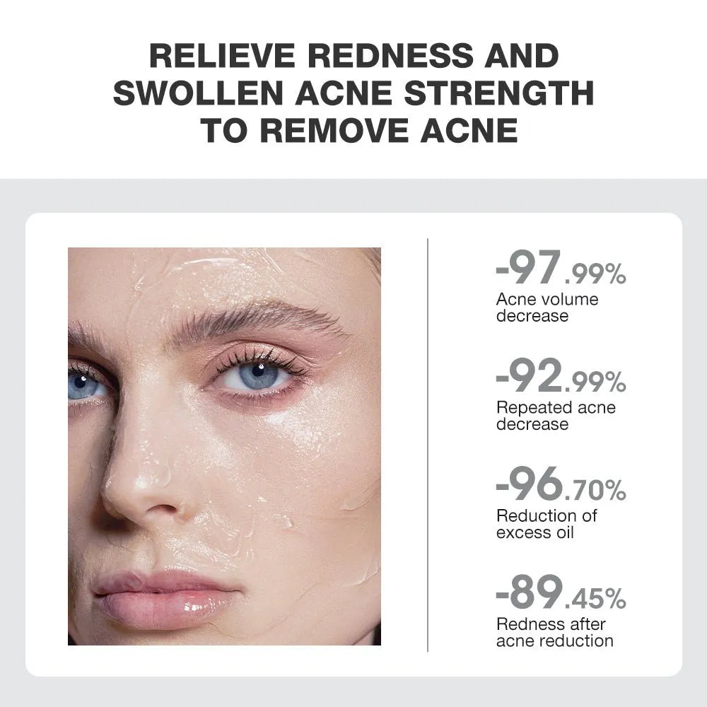 SKINEVER Salicylic Acid Acne Treatment Ice Sleep Masque 55ML