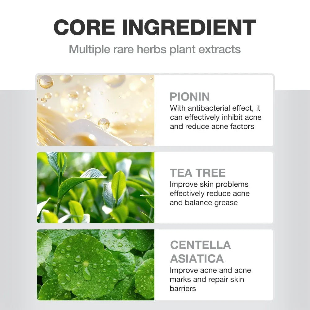 SKINEVER Salicylic Acid Acne Treatment Ice Sleep Masque 55ML