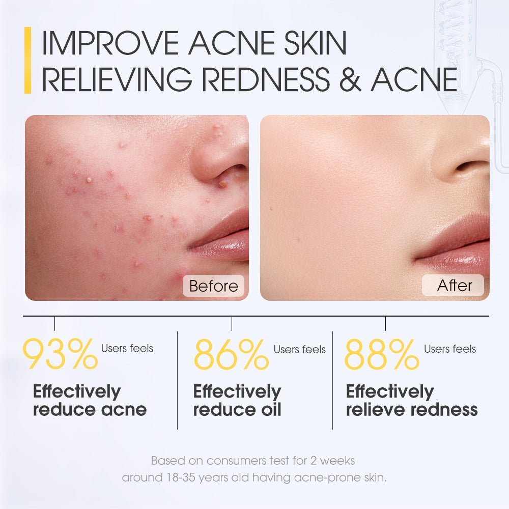 Salicylic Acid Acne Treatment Ice Sleep Masque-Travel Size 20 ML