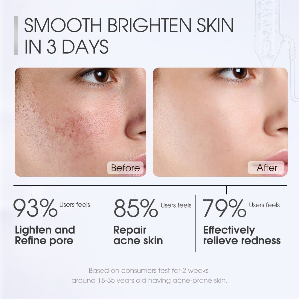 Salicylic Acid Deep Pore Cleansing Masque