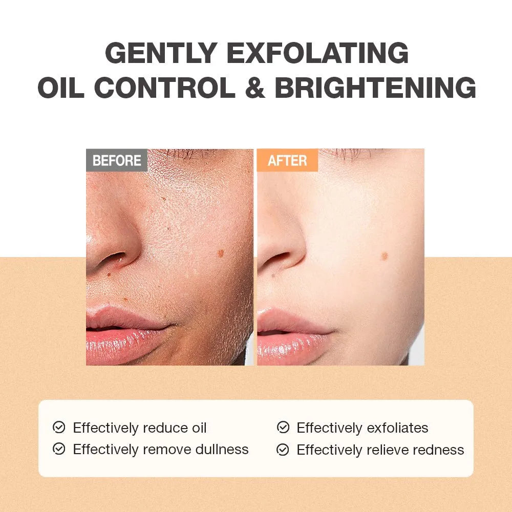 SKINEVER Salicylic Refreshing Scrub Cleanser-Facial wash