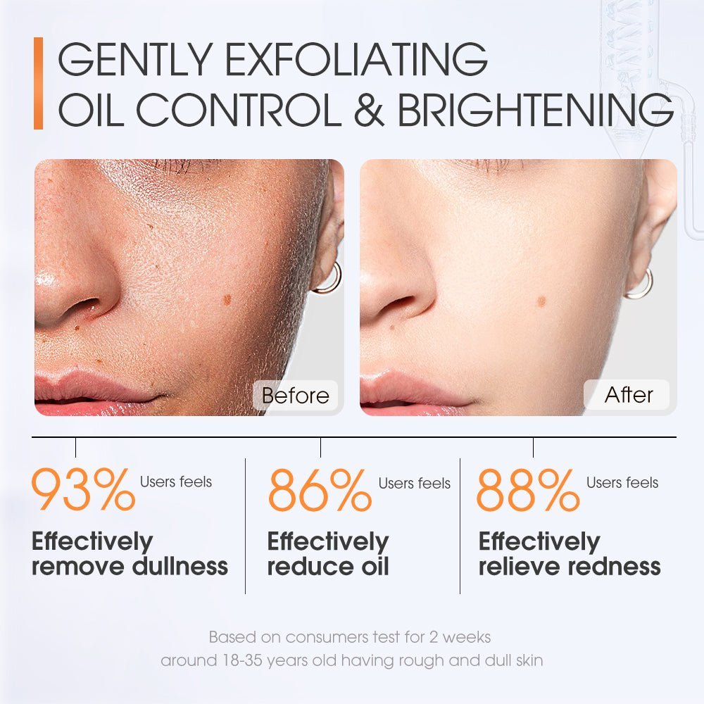 Salicylic Refreshing Scrub Cleanser-Travel Size 20ML