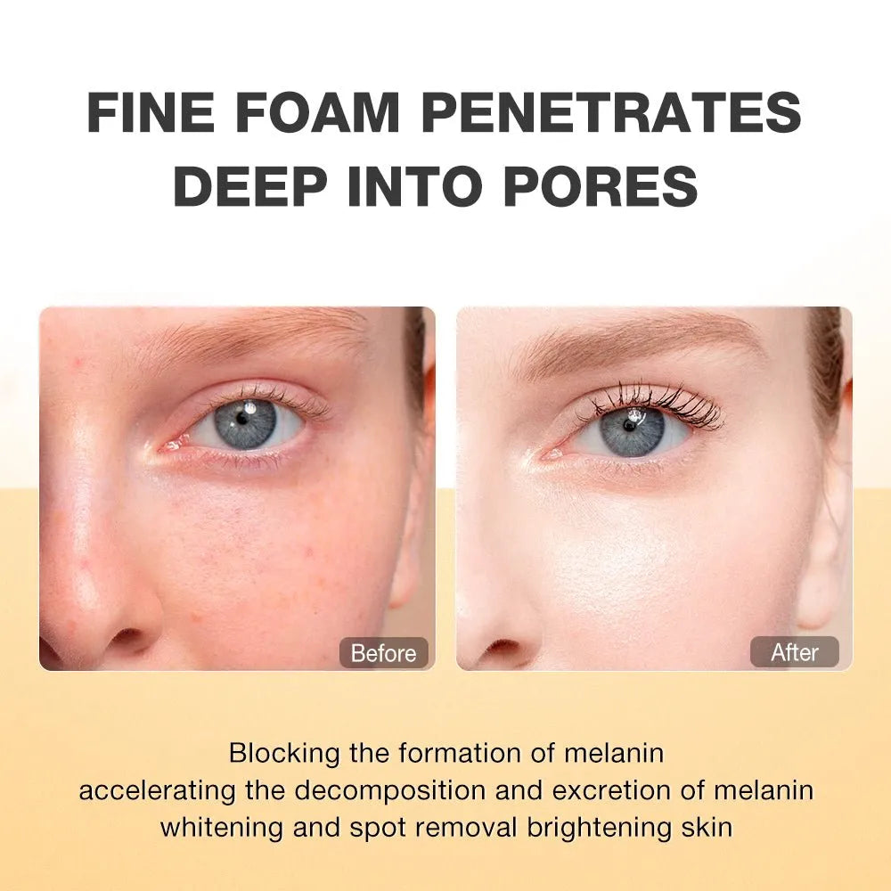 SKINEVER Vitamin C Whitening Facial Cleanser